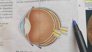 Myopia refractive error theory exam notes AK Khurana [upl. by Mezoff873]