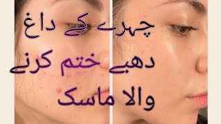 Best face Acne removal mask at home 😱shorts youtubeshorts skincare whitening trending video [upl. by Abroms]