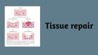 Tissue repair  pathology regeneration scarformation angiogenesis labilecells stable cells [upl. by Matilda30]