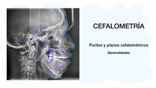 PUNTOS CEFALOMÉTRICOS  Cefalometría 💀🦷✅ [upl. by Ruby]