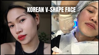 HOW TO ACHIEVE KOREAN VSHAPE FACE  EXILIS REVIEW [upl. by Blanc]