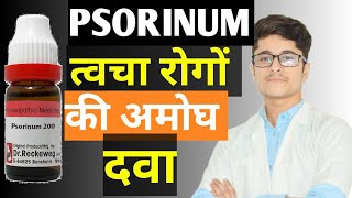 Psorinum 1M  Psorinum 200 Homoeopathic Medicine uses in Hindi [upl. by Gorski563]