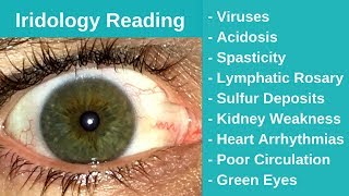 Iridology Reading  Viruses and Acidosis [upl. by Codd695]