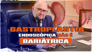 DIFERENÇA entre a GASTROPLASTIA ENDOSCÓPICA e a CIRURGIA BARIÁTRICA [upl. by Camel641]