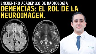 V Encuentro Académico de Radiología Demencias  El rol de la neuroimagen [upl. by Lirrad]