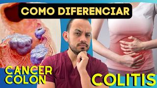 Diferencias en los Síntomas de Cáncer de Colon vs Colitis Estudios que se pueden realizar [upl. by Bellew]