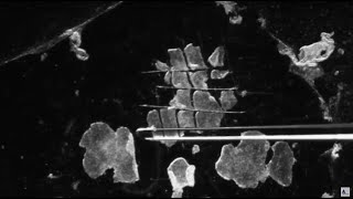 3 Methods for Passaging of Pluripotent Stem Cells [upl. by Garibold497]