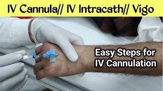 IV Cannula कैसे लगाते हैं  Intracath कैसे लगाते हैं  vigo कैसे लगाते हैं IV Cannulation [upl. by Slosberg275]