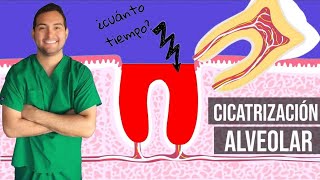 CICATRIZACIÓN ALVEOLAR DESPUÉS DE UNA EXTRACCIÓN DE MUELA 👄 2018 30 [upl. by Oribella]