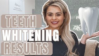 4 Factors That Effect Teeth Whitening Results From a Teeth Whitening Technician [upl. by Irma69]