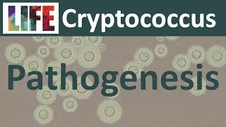 Cryptococcal meningitis pathogenesis and host response [upl. by Milka]