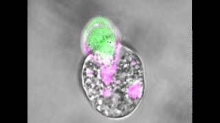 An amoeba eating a human cell [upl. by Anahs]