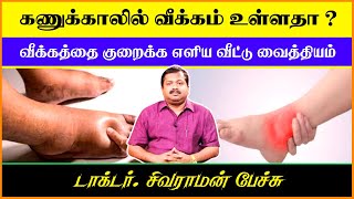 கணுக்கால் வீக்கத்தை குறைக்க சில எளிய வழிகள்   Dr Sivaraman Speech in Tamil  Ankles Swollen Remedy [upl. by Rein862]