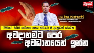 මොකක්ද මේ ටීනියා දිලීර රෝගය  අවදානමට පෙර අවධානයෙන් සිටින්න tinea virus vidusara [upl. by Drawets164]