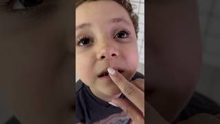 O dia que o Caio Caiu na escola e foi parar no hospital🥹😱 shortsvideo escola hospital [upl. by Llenod]