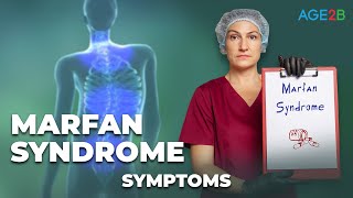 Marfan Syndrome Symptoms [upl. by Rol]