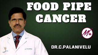 Adenocarcinoma  Food Pipe Cancer  Esophageal Cancer   DrCPalanivelu [upl. by Arrakat643]