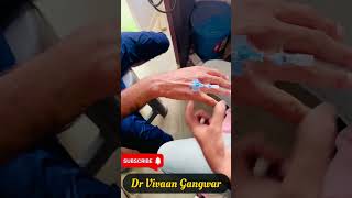 How to Insert Cannula  Cannula Insertion  IV Cannula  IV CATH  कैनुला लगाने का तरीका shorts [upl. by Perzan]