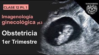 121  Imagen en Obstetricia 1er Trimestre [upl. by Enneiluj170]