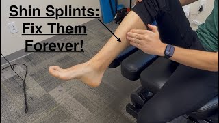 Shin Splints and How to Fix Them on Your Own Forever With Dr Leo Kormanik [upl. by Lessig]