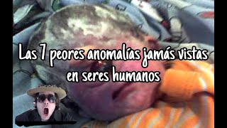 Las 7 peores anomalías jamás vistas en seres humanos [upl. by Jany]