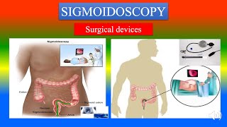 SIGMOIDOSCOPY Definition  parts uses  Precautions How to use   Surgical Devices [upl. by Artined997]