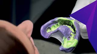 3M™ Impregum™ Super Quick Polyether Impression Material [upl. by Leitman706]