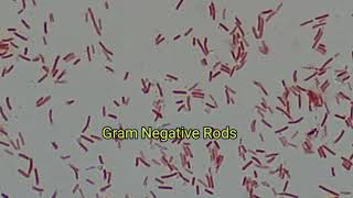 Gram Negative Rods Bacilli of Klebsiella pneumoniae under the Microscope [upl. by Terena29]