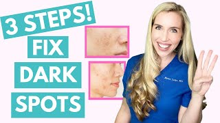 Fix Your Dark Spots in 3 Steps  Hyperpigmentation  Melasma  Skincare Made Simple [upl. by Pat]