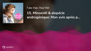 15 Minoxidil amp alopécie androgénique Mon avis après plus de 5 ans de traitement [upl. by Cello]