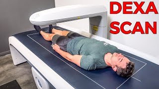 Vegan tests Body Fat  Muscle Mass  Bone Density etc  DEXA SCAN [upl. by Lowenstern]