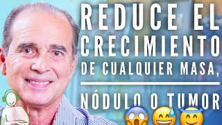 Reduce El Crecimiento De Cualquier Masa Nódulo O Tumor  Pregúntale A Frank 11 [upl. by Ggerc]