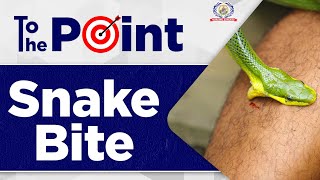 Snake Bite  Snake Bite First Aid Emergency Treatment Management in Hospital  Nursing Experts [upl. by Gnouhk]