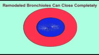 AP2 EXAM 2 BRONCHOCONSTRICTION amp BRONCHODILATIONavi [upl. by Ybbil]