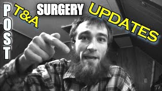 EXO Life UPDATE Post Op Tonsillectomy  Adenoid Surgery VLOG  DAY 12 Recovery [upl. by Askwith412]