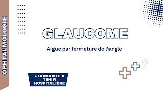 Glaucome aigue par fermeture de langle Rappel physiopathologie formes cliniques DC positif CAT [upl. by Salohci]