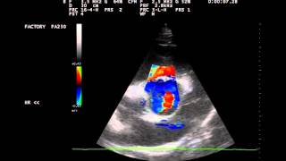 Herzultraschall Aortenklappeninsuffizienz beim Pferd [upl. by Dewain332]