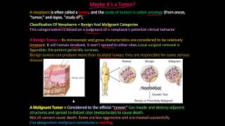 111P  What is a tumor Classification of Neoplasms  Benign and Malignant [upl. by Stelmach679]