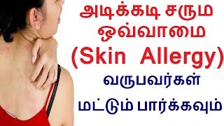 அடிக்கடி சரும ஒவ்வாமை Skin Allergy வருபவர்கள் மட்டும் பார்க்கவும்  Remedies for skin rashes tamil [upl. by Iarised]