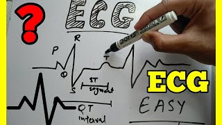 How to Read ECG in Hindi easy wayECG reading in Hindi ECG interpretation make easy ECG [upl. by Josler]