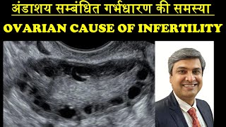 अंडाशय सम्बंधित गर्भधारण की समस्या  OVARIAN CAUSE OF INFERTILITY [upl. by Wylma387]