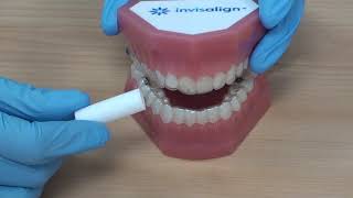 How to use Chewies with your orthodontic aligners [upl. by Tiloine]