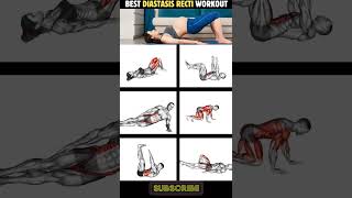 6 Best Diastasis Recti Workout Routine workout diastasisrectiexercises [upl. by Yecnay]