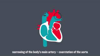 Congenital Heart Conditions [upl. by Okika]