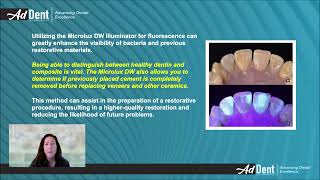 Microlux DW Illuminator Makes dental evaluations more effective [upl. by Aissak646]