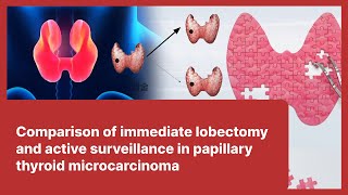 15 Comparison of immediate lobectomy and active surveillance in papillary thyroid microcarcinoma [upl. by Slater772]