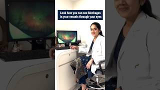 Blockages in the blood vessels of the eye  Fundus image  Dr Vishma Prabhu eyecareprofessionals [upl. by Nabala443]