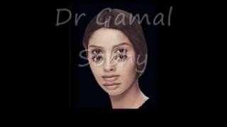 Diplopia  ازدواج الرؤية [upl. by Tsepmet]