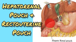 Hepatorenal pouch amp Rectouterine pouch [upl. by Emmerie357]