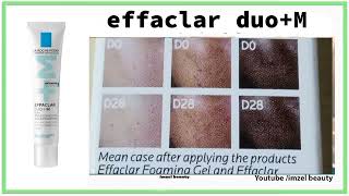 effaclar duo M 2024 منتج رائع ضد حب الشباب و اثاره و لكن ضروري من الاستعمال الصحيح [upl. by Yanttirb]